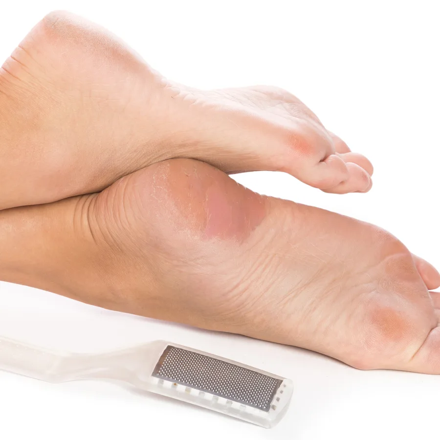 Foot file, alat pembersih callus untuk menghaluskan tumit